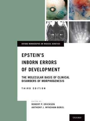 cover image of Epstein's Inborn Errors of Development